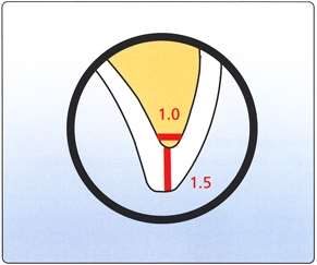 2 (1)